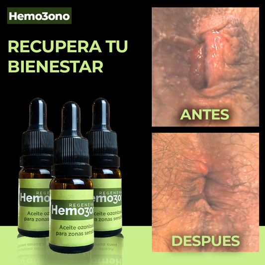 Hemozono | adios a la Hemorroides